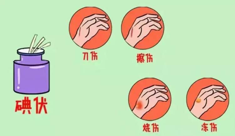 选择困难!紫药水,红药水,酒精,碘伏……哪种处理伤口好?