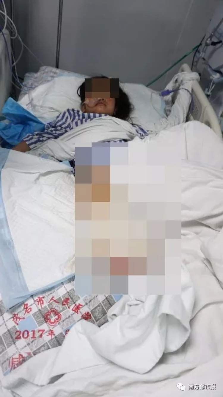 广东茂名一名10岁女孩上厕途中,脚底不慎扎到了一颗钉子.