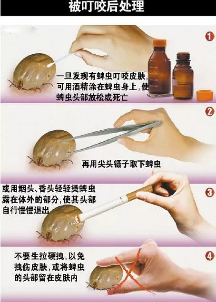 两人因蜱虫叮咬身亡这个季节最高发被叮咬千万别用手拍打